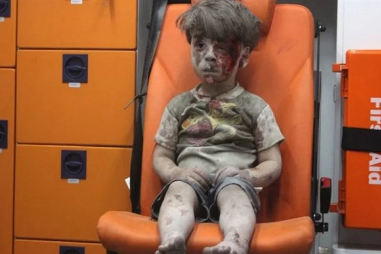 Suriye'nin sembol çocuğu Ümran'dan kötü haber!