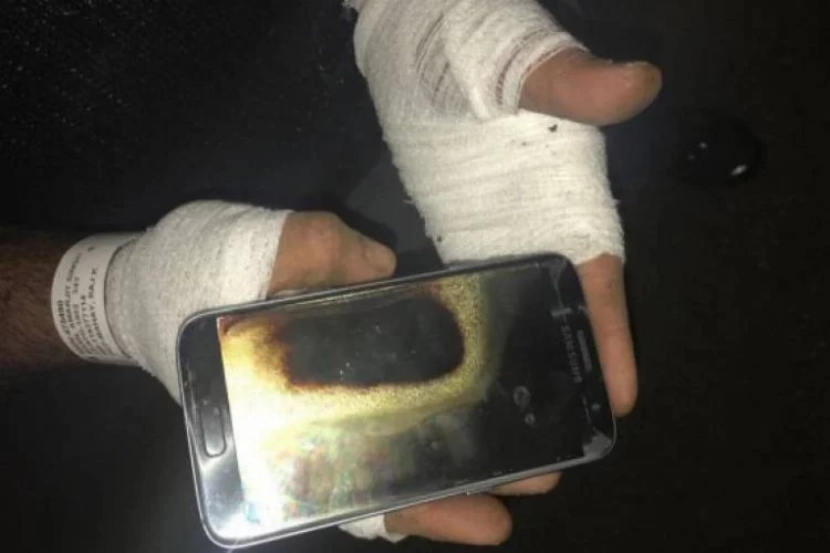 Galaxy S7, yüzünde patladı