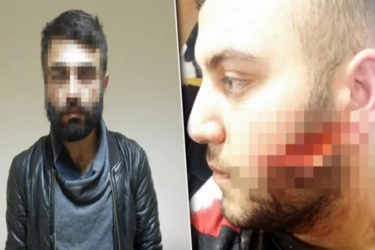 Bursa'da dehşet! Döner bıçağıyla yüzünü kesti