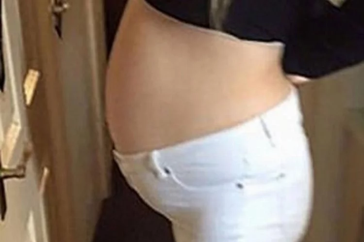Herkes 7 aylık hamile sanıyordu! Doktor şoke eden gerçeği açıkladı