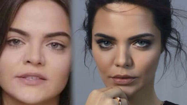 Estetiksiz hali şaşkınlık yarattı