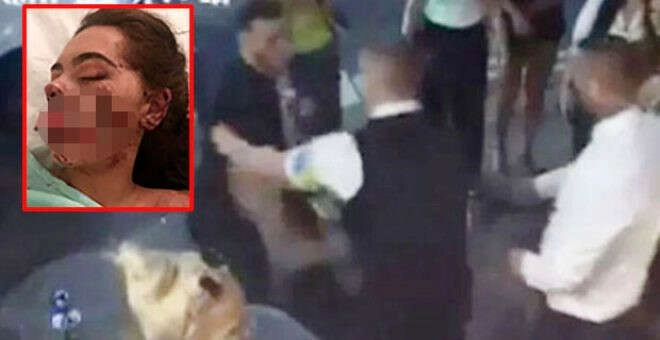 Gece kulübünün önünde genç kadının ağzı parçalandı!