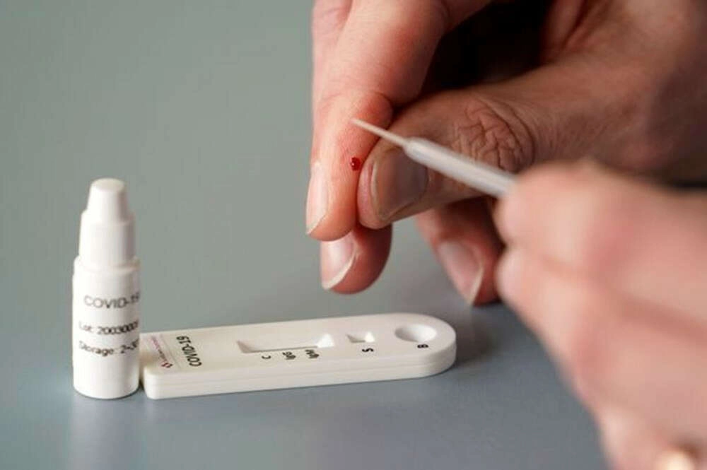 Antikor testi nedir ve neden yapılır? İşte tüm detaylar...