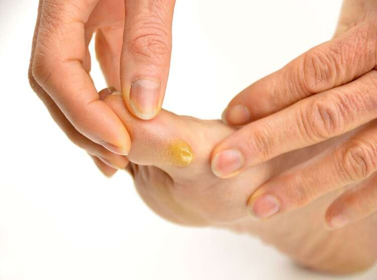 İşte nasıra evde kalıcı çözüm!