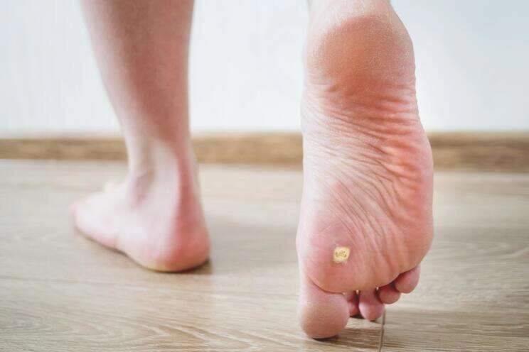 Nasırları kökünden söküp atan çözüm!