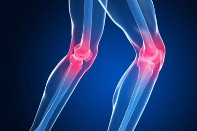 Diz kireçlenmesi rahatsızlığında yeni nesil: Hidrojel Tedavisi