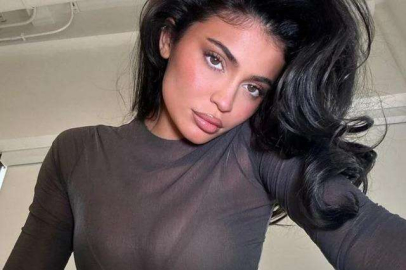 Kylie Jenner eski haliyle gündemde! "Sadece dolgum var" deyince..