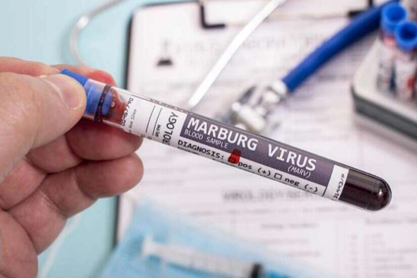 Dünyayı tehdit eden Marburg virüsü! Yaygın kanama görülebiliyor