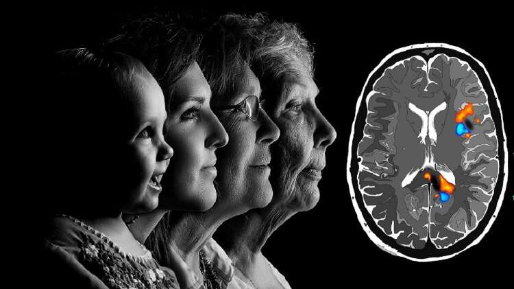 7. Alzheimer hastalığı ve diğer demans türleri