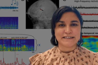 Konuşamayan hastalar için müthiş gelişme! Türk profesör detayları anlattı