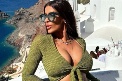 Adanalı’nın Pınar’ı Tuğçe Özbudak'ı görenler tanıyamıyor! Estetikle bambaşka biri oldu