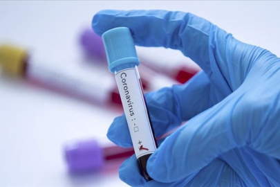 Covid-19 laboratuvarda mı üretildi? ABD istihbaratı ikiye bölündü