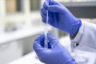 SMA'da erken tedavi komplikasyonların etkisini azaltıyor