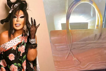 Bülent Ersoy’a milyonluk jest