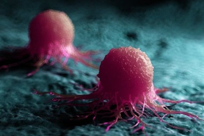 Yeni kanser araştırması korkuttu: Virüs gibi yayılıyor