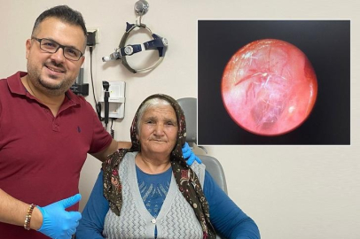 Kulağındaki hışırtı için hastaneye gitti... Yuva yapmış canlıydı!