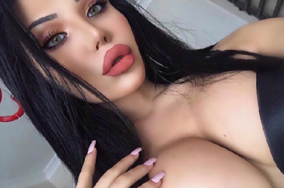 Cinsiyet değiştirip 30'a yakın ameliyat geçirmişti!