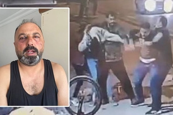 “Ne bakıyorsun” tartışmasında öldüresiye dayak