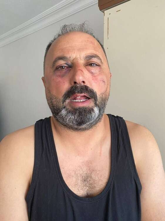 BABA VE OĞLU HASTANEYE KALDIRILDI