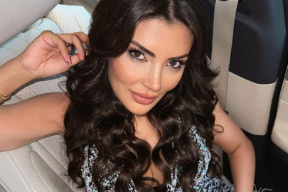 Dilan Polat'ın eski ortağı Nez Demir'in estetiksiz hali gündem oldu!