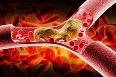 Kan yağları neden yükselir? Nelere dikkat etmeliyiz?