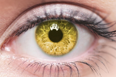 Sarı nokta hastalığı nedir? &nbsp;