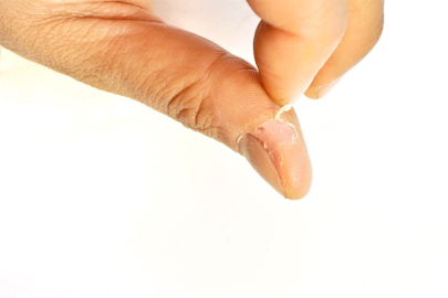 Neden derimizi yolarız? Nasıl engel oluruz