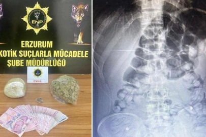 Erzurum'da yolcunun midesinden afyon sakızı çıktı!