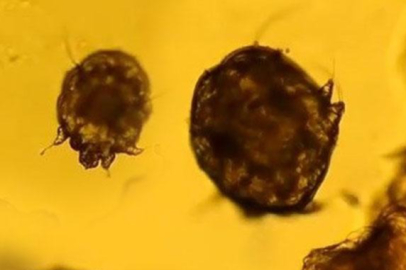 Gece kaşıntılarına dikkat! Vaka sayısı her geçen gün artıyor