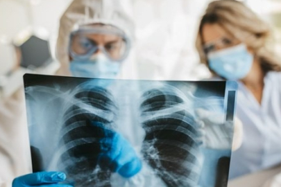 İngiltere'de endişelendiren virüs! İlk kez bir insanda...