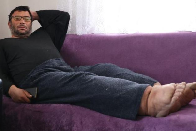 25 yıldır tedavisi olmayan hastalıkla mücadele ediyor: Bacakları 80 santimetre çapına ulaştı