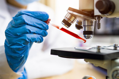 Kan testiyle hızlı ve yavaş yaşlanan organlar tespit edilebilir