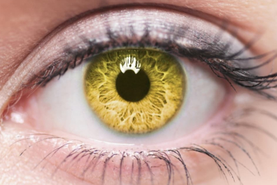 Sarı Nokta hastalığı nedir?