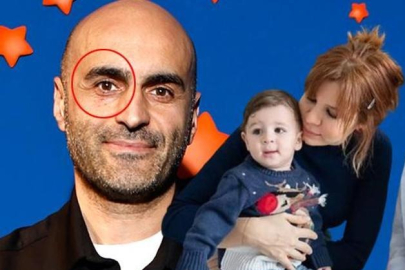 Alper Kul'un çocukları gözünü morarttı!