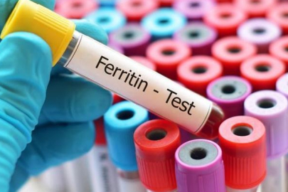Ferritin nasıl yükseltilir veya düşürülür? Ferritin nasıl tedavi edilir?