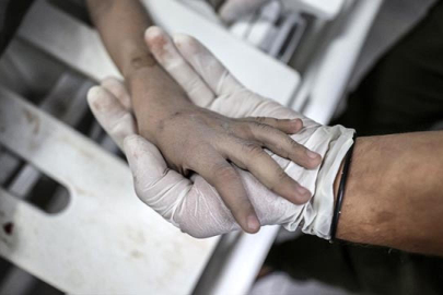 Gazze'de, İsrail'in saldırılarında yaralanan Filistinli çocuklar çektikleri acıyı anlattı