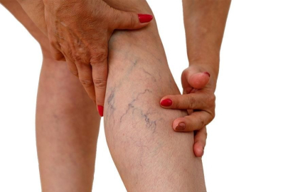 Varis sorununa dikkat!&nbsp;