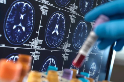 Hastalık parmaklardan beyne geçiyor! Elini burnunuza götürürken...