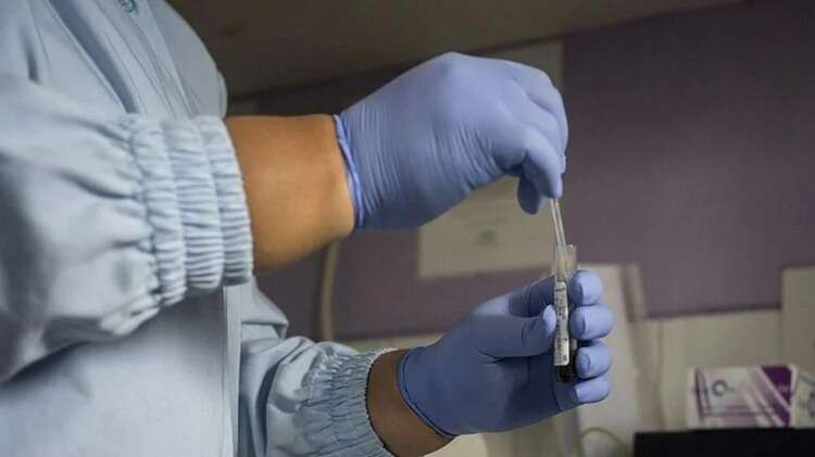 HIV VİRÜSÜ KORUNMA YOLLARI