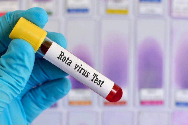 Rota virüsü nedir, nasıl bulaşır? Rota virüsü belirtileri