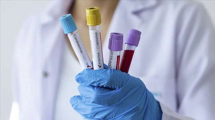 ROTA VİRÜS BELİRTİLERİ NELER?