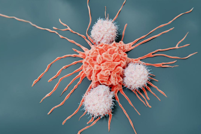 Erkeklerde ve kadınlarda en çok görülen kanser türleri