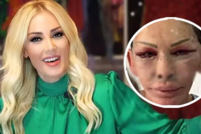 Estetik ameliyatı olan Esra Süay Toğuş'un son hali şaşırttı