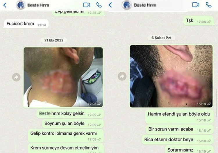 "PSİKOLOJİK SORUNLAR YAŞIYORUM"