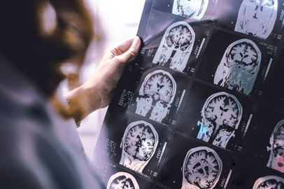 Dondurulmuş insanlar hayata dönebilecek