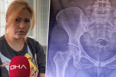 Doğumda vücudunda unutulan gazlı bez unutuldu! 10 ay sonra fark edildi...