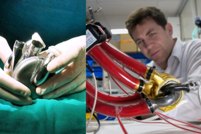 İlk mekanik yapay kalp başarıyla nakledildi