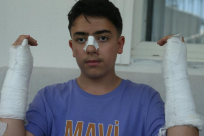 Kars'ta başıboş köpeğin saldırdığı çocuk yaralandı