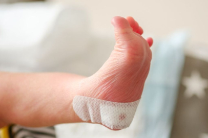 Topuk kanı, kayyum atanan bebek sonrası yeniden gündemde! Rakamlar ürküttü: 5 kat arttı