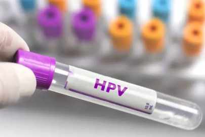 Türkiye'de 9 milyon civarında HPV pozitif kadın ve erkek olduğu tahmin ediliyor